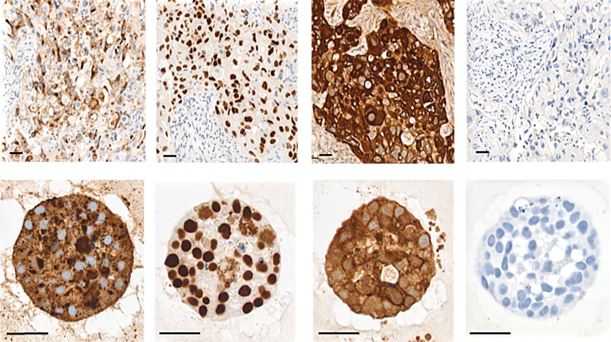 Winn Lab:  The Role of PRMTs in Lung Cancer